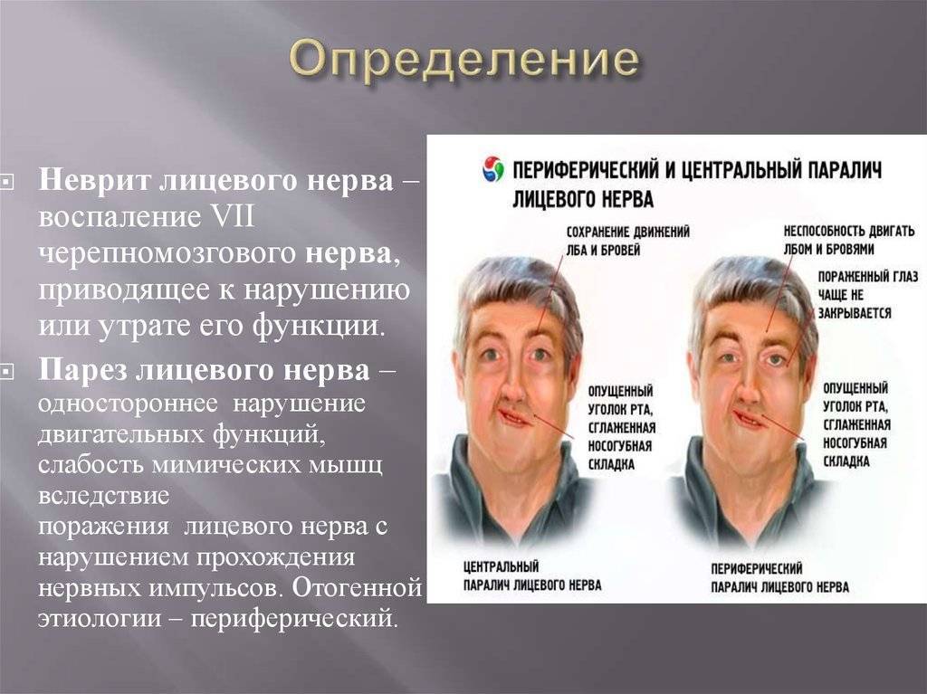 Носогубные складки