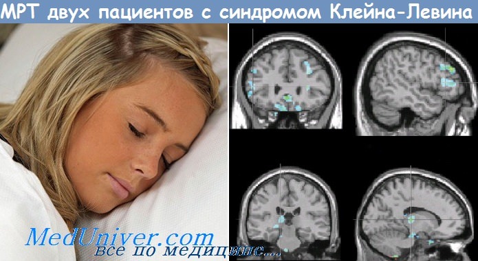Что такое летаргический сон? методы диагностики. как помочь?