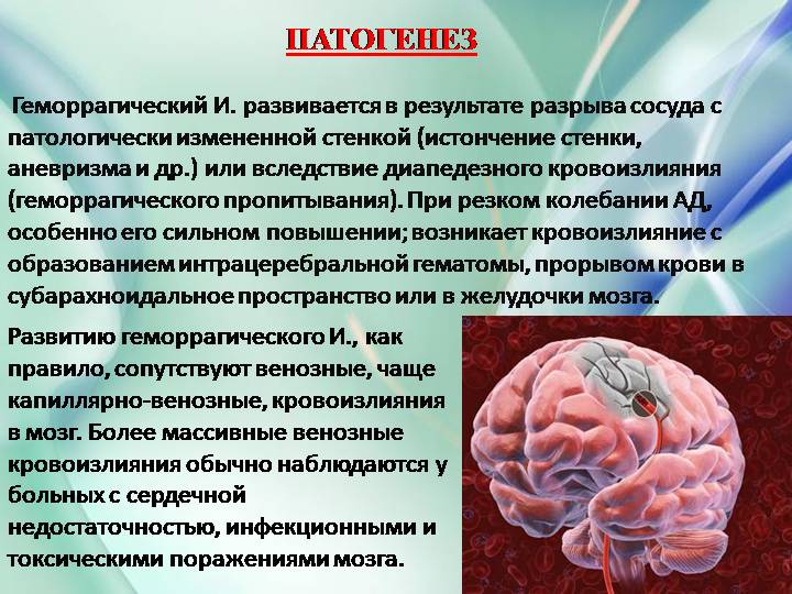 Причины заболевания головного мозга. ОНМК геморрагический инсульт. Кровоизлияние в мозг механизм развития патанатомия. Патогенез развития геморрагического инсульта. Геморрагический инсульт кровоизлияние в мозг.